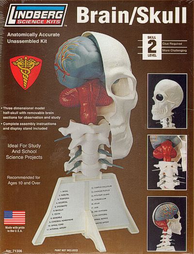 Lindberg LI71306 Half Skull Anatomy Model with Removable Brain
